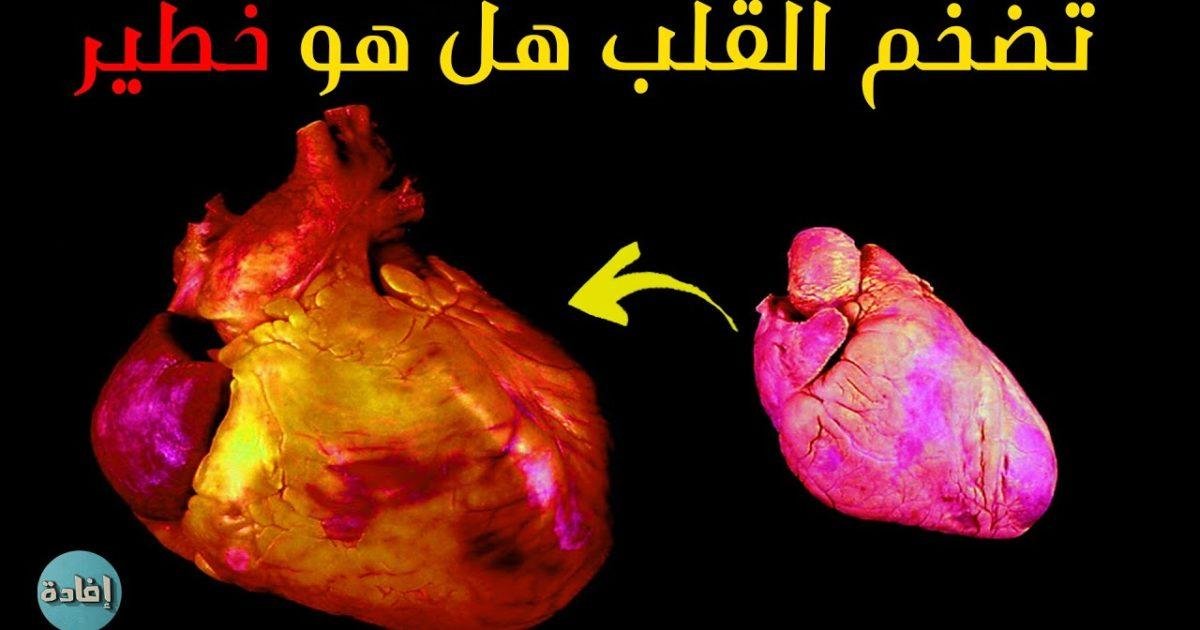 عيادة الدكتور وليد اسماعيل - جراحة قلب الاطفال