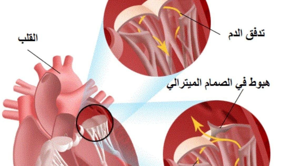 عيادة الدكتور وليد اسماعيل - جراحة قلب الاطفال