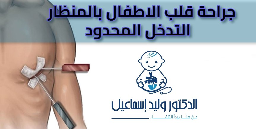 عيادة الدكتور وليد اسماعيل - جراحة قلب الاطفال